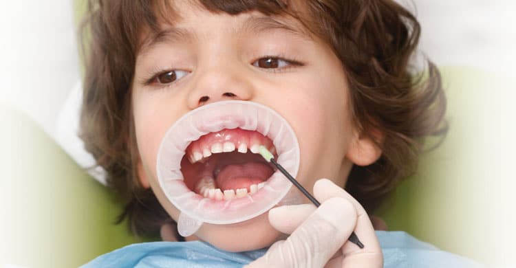 fluorizare-dentara-copii-edentkids-copil-la-stomatolog