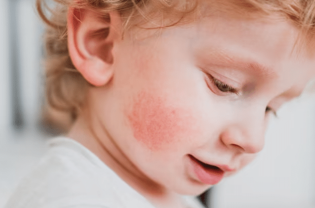 alergii-vs-intolerante-alimentare-copii